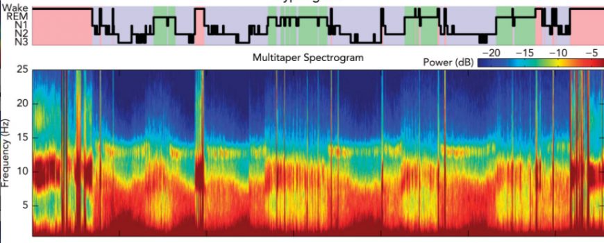 Hypnogram Schlafarchitektur