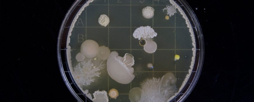 Mikrobiologie, Bakterien, Klimawandel © Michael Schiffer on Unsplash Mikrobiologie, Bakterien, Klimawandel © Michael Schiffer on Unsplash